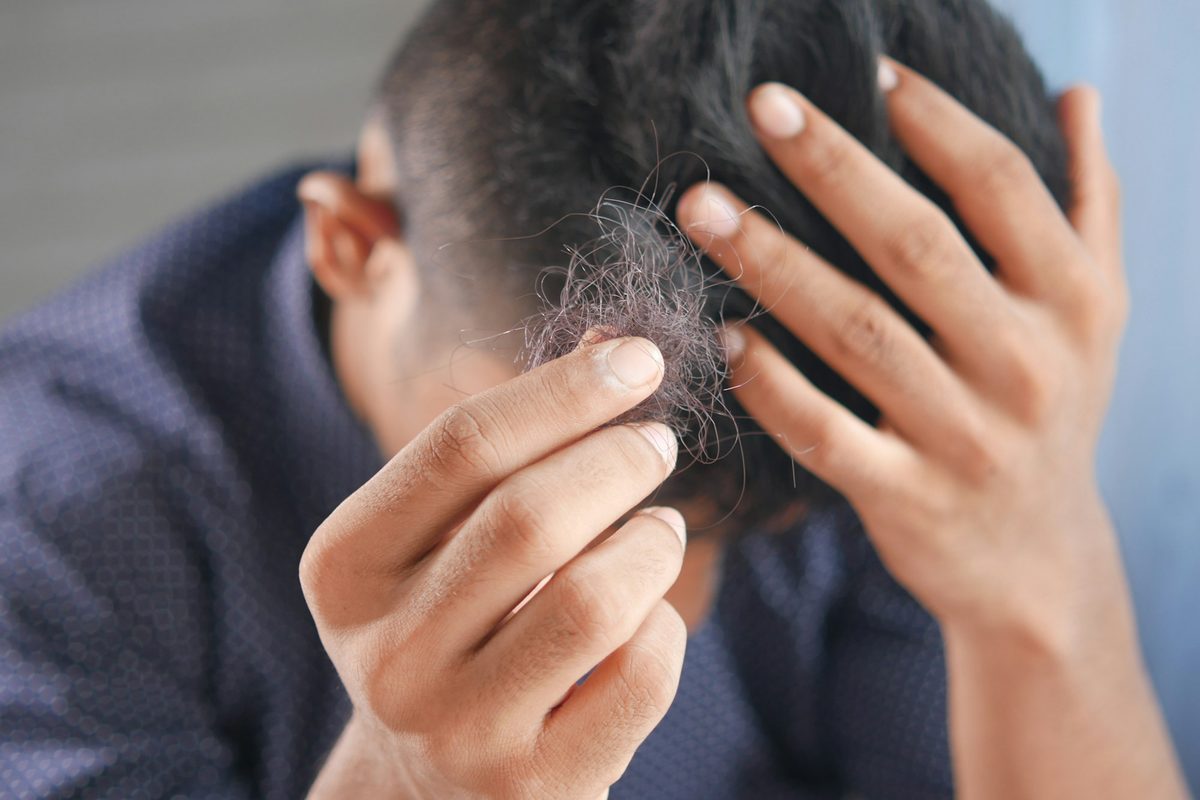 Hombre mirando el pelo que se le ha caído en la mano